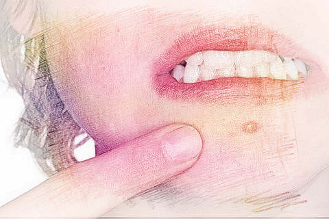 梦见下巴长痘　周公解梦之梦到下巴长痘