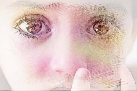 梦见眼珠变白　周公解梦之梦到眼珠变白