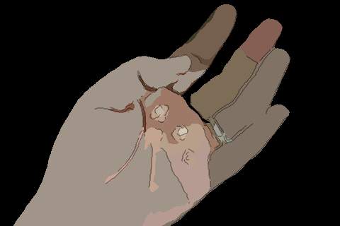 梦见手掌起泡　周公解梦之梦到手掌起泡