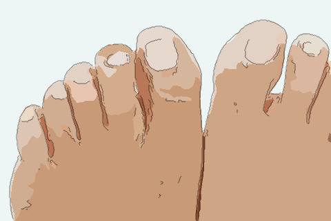 梦见脚趾发紫　周公解梦之梦到脚趾发紫