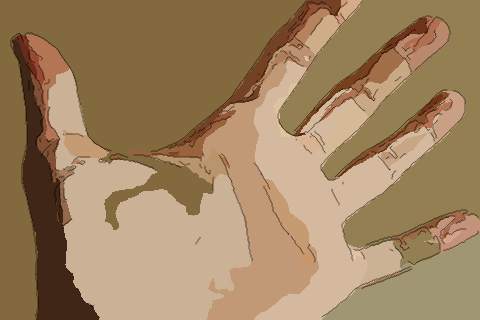 梦见手掌发紫　周公解梦之梦到手掌发紫