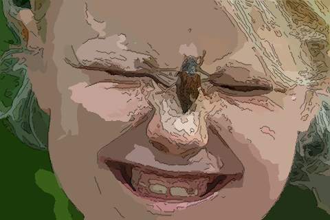 梦见鼻里有虫　周公解梦之梦到鼻里有虫