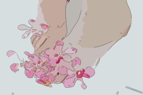 梦见脚被烫红　周公解梦之梦到脚被烫红