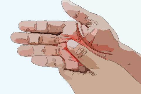 梦见身体麻木　周公解梦之梦到身体麻木