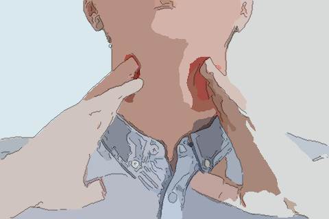 梦见脖子发红　周公解梦之梦到脖子发红