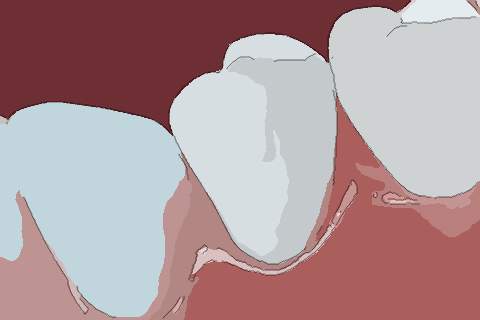 梦见牙齿松了　周公解梦之梦到牙齿松了