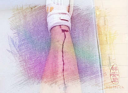 梦见男友受伤　周公解梦之梦到男友受伤