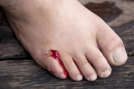 梦见自己脚流血