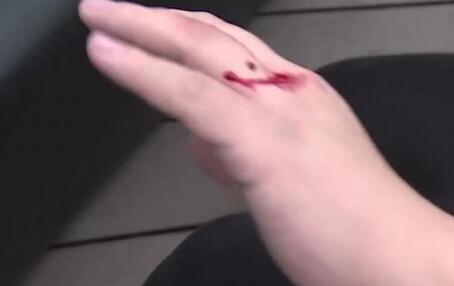 梦到亲人手上流血