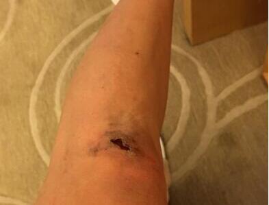 梦见老公脚受伤