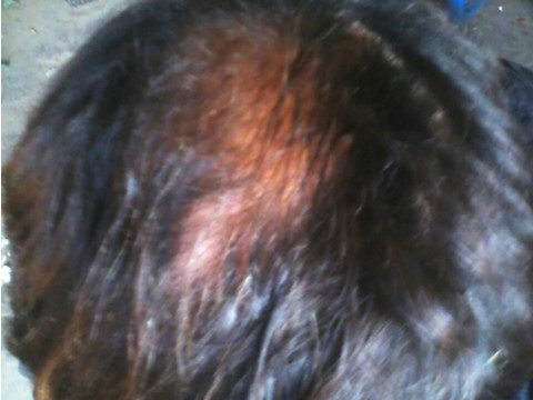 梦见别人掉头发一缕