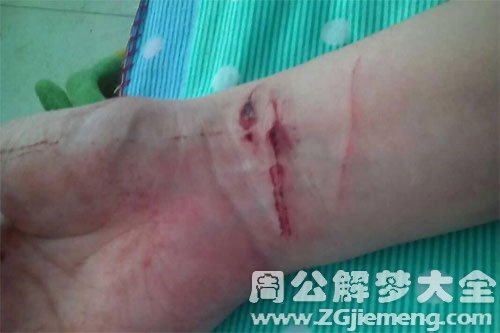 【梦见别人割腕自杀】