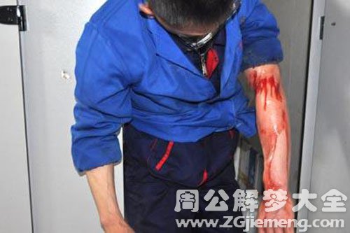 【梦到手臂流血】