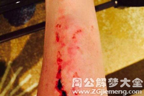 【梦到胳膊流血】